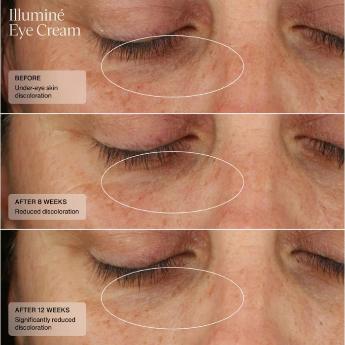 อายครีม Senté Illumine Eye Cream อายครีม Senté Illumine Eye Cream