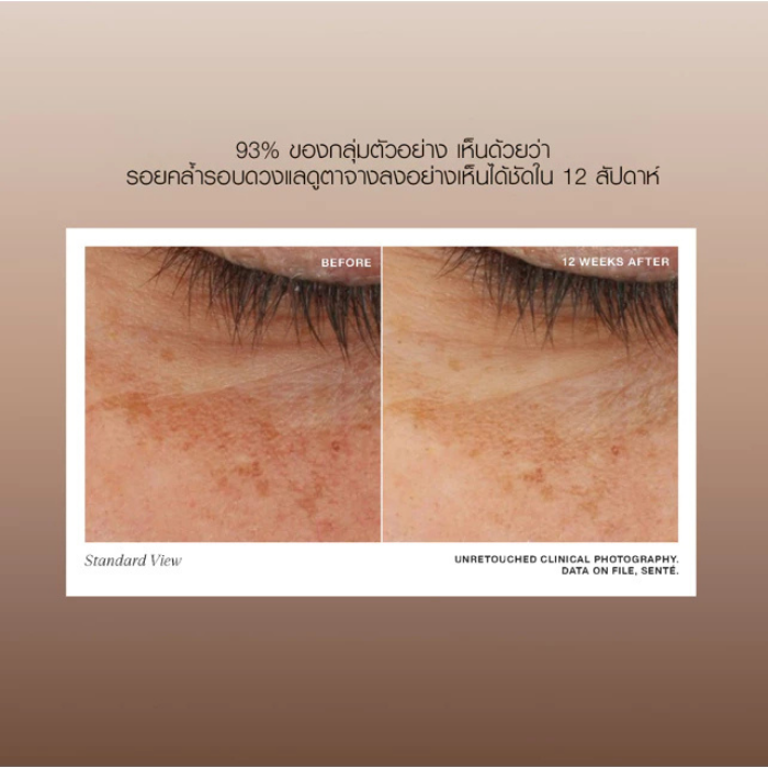 อายครีม Senté Illumine Eye Cream อายครีม Senté Illumine Eye Cream