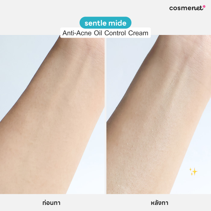 มอยส์เจอร์ไรเซอร์สำหรับผิวมัน sentle mide Anti-Acne Oil Control Cream