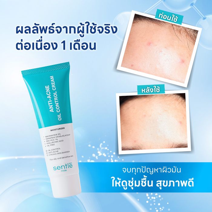 มอยส์เจอร์ไรเซอร์สำหรับผิวมัน sentle mide Anti-Acne Oil Control Cream