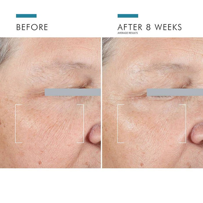 ครีมบำรุงรอบดวงตา SkinCeuticals A.G.E. Advanced Eye for Dark Circles