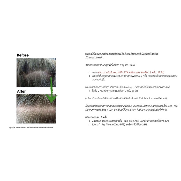 ผลิตภัณฑ์บำรุงหนังศีรษะ Skin Syrup Flakefree Anti-Dandruff Tonic