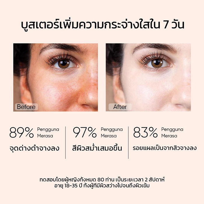 เซรั่ม SKINTIFIC 10% Niacinamide Serum