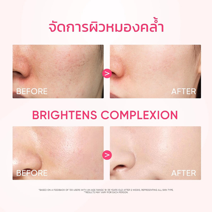 โทนเนอร์ SKINTIFIC Niacinamide Brightening Essence Toner