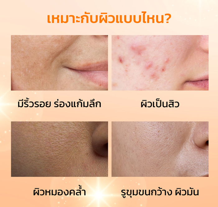 เซรั่ม SKINTIFIC Retinol Skin Renewal Serum