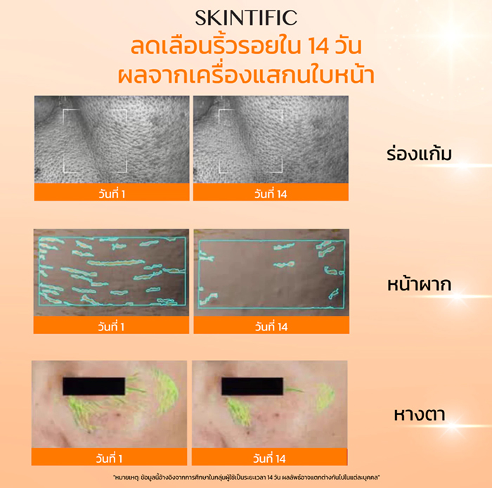 เซรั่ม SKINTIFIC Retinol Skin Renewal Serum