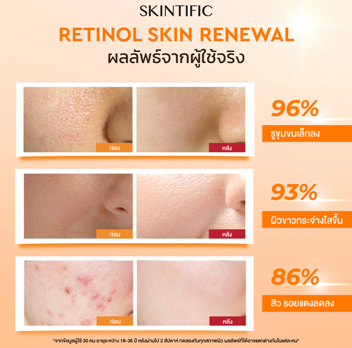 เซรั่ม SKINTIFIC Retinol Skin Renewal Serum