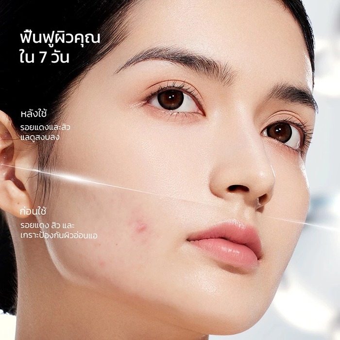 ครีมบำรุงผิวหน้า SKINTIFIC Sensitive Moisture Gel