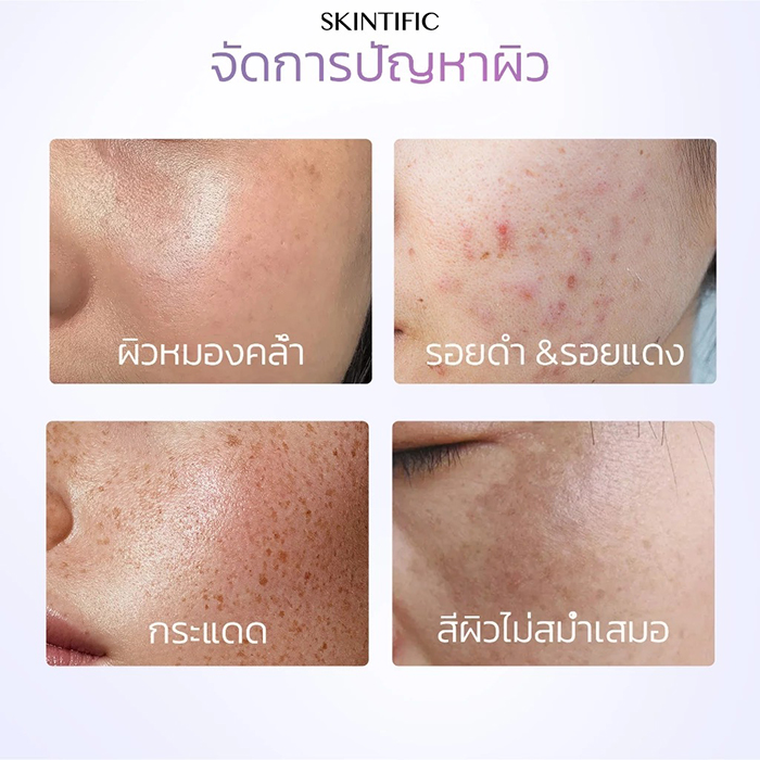 มอยเจอร์ไรเซอร์ SKINTIFIC Symwhite 377 Dark Spot Moisture Gel