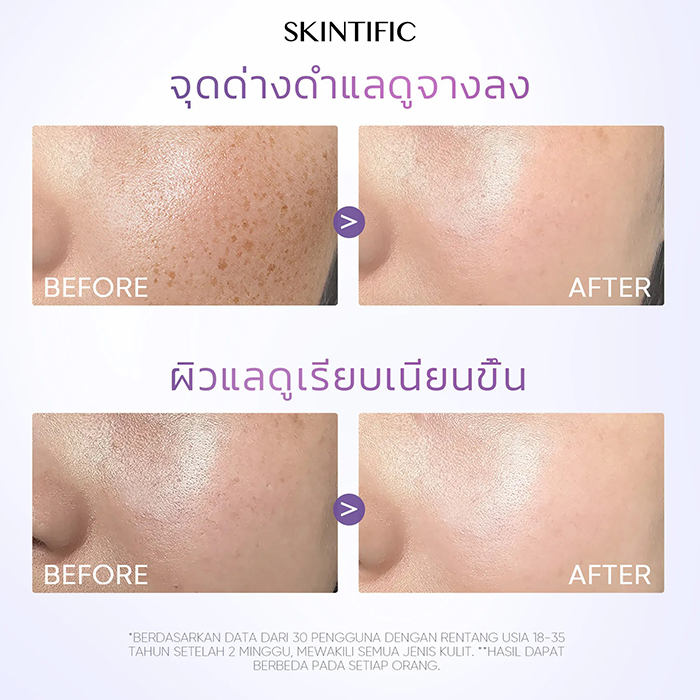 มอยเจอร์ไรเซอร์ SKINTIFIC Symwhite 377 Dark Spot Moisture Gel