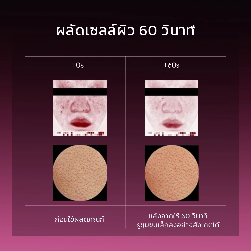 เซรั่มแดงบำรุงผิว  SKINTIFIC AHA BHA PHA LHA Peeling Solution