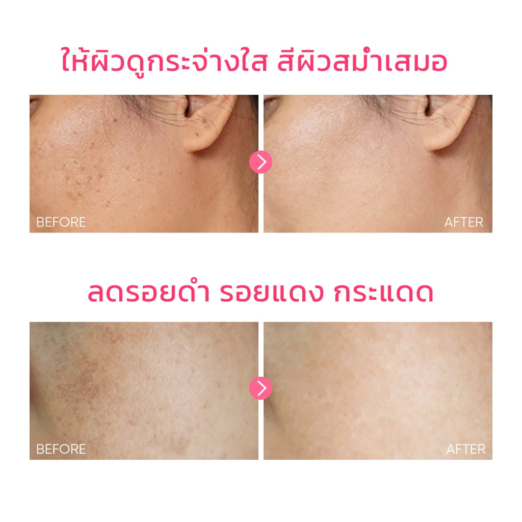 ครีมบำรุงผิวหน้า SKINTIFIC MSH Niacinamide Brightening