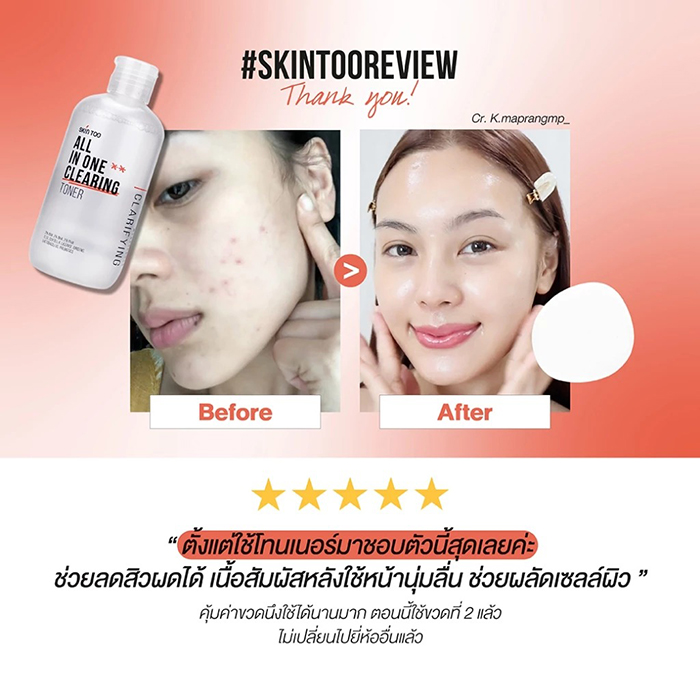 โทนเนอร์ SKINTOO All In One Clearing Toner