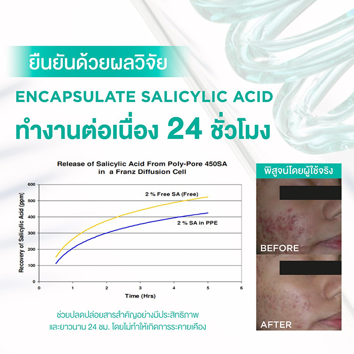 เจลแต้มสิว Smooth E Acne-5 Rapid Action Plus เจลแต้มสิว Smooth E Acne-5 Rapid Action Plus