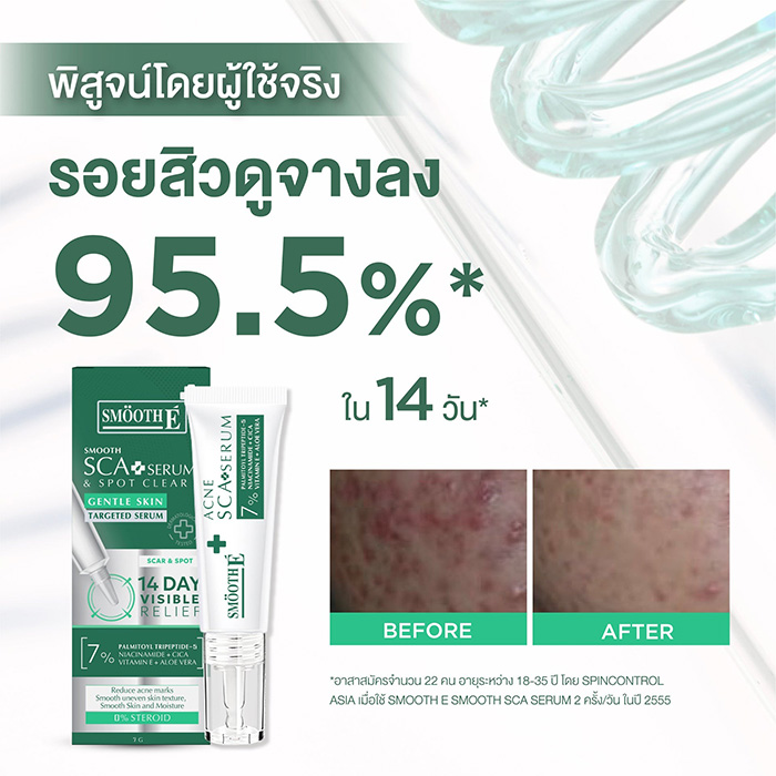 เซรั่ม Smooth E Acne Scar Serum