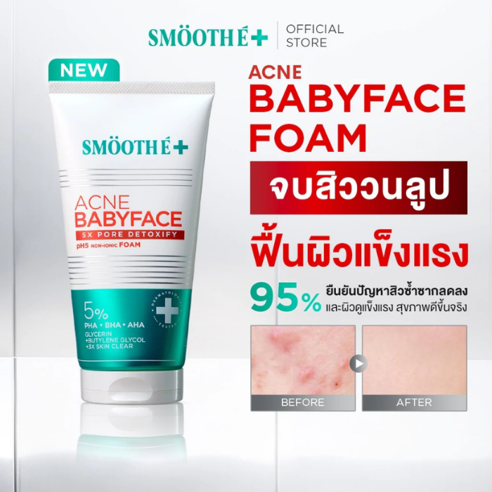 โฟมล้างหน้า Smooth E Babyface Acne-5 Detoxify Non-Ionic Foam