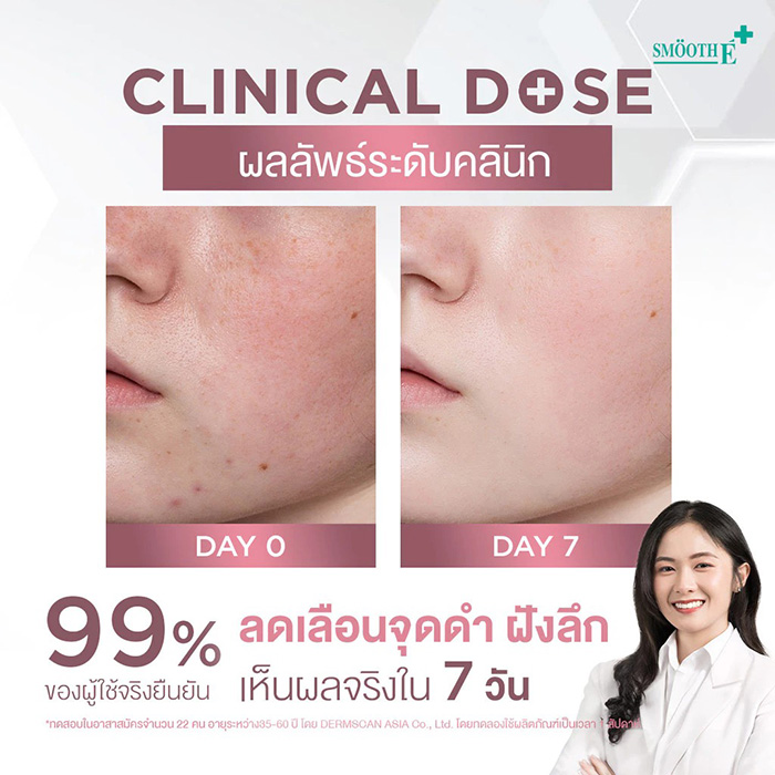 เซรั่ม Smooth E Gluta B3 Cellular Bright Serum