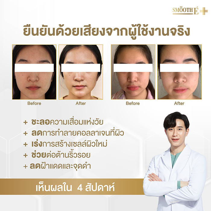 ครีมบำรุงผิวหน้า Smooth E Gold Cream