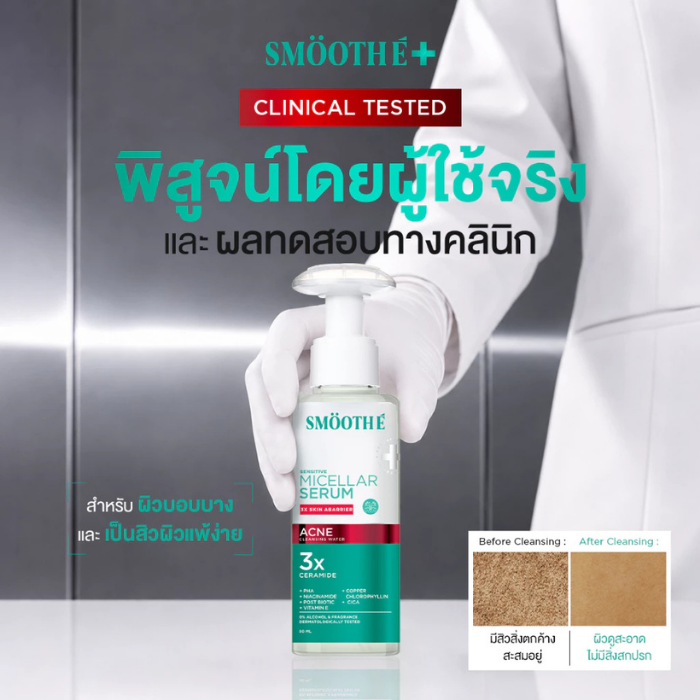 คลีนซิ่งสูตรลดสิว Smooth E Micellar Serum Acne Cleansing Water