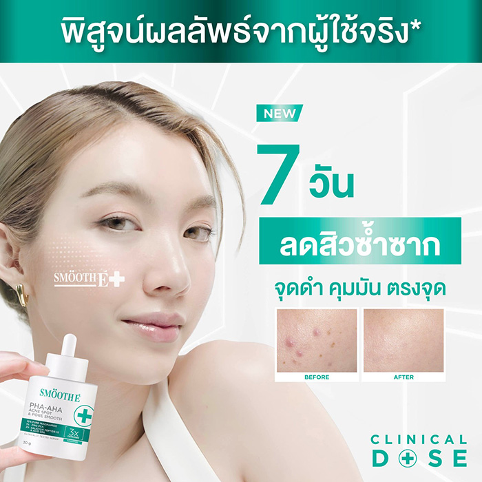 เซรั่ม Smooth E PHA-AHA Acne Spot and Pore Smooth