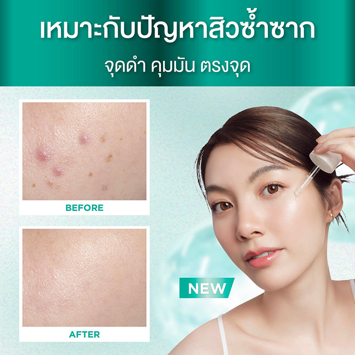 เซรั่ม Smooth E PHA-AHA Acne Spot and Pore Smooth