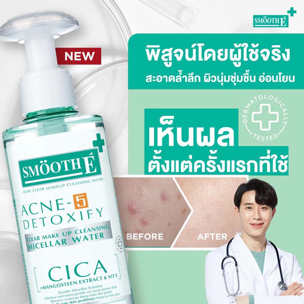 คลีนซิ่งล้างเครื่องสำอาง Smooth E Acne-5 Clear Makeup Cleansing Water