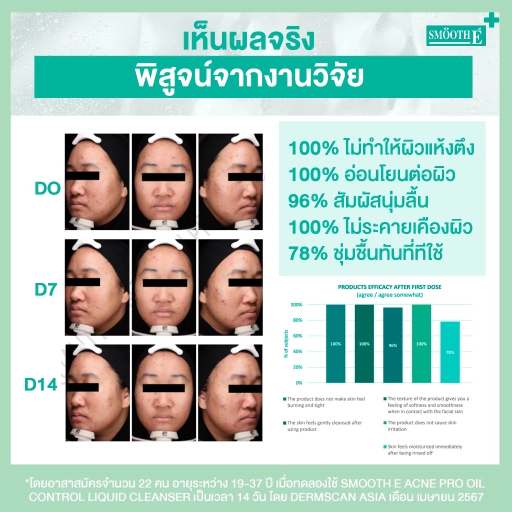 เจลล้างหน้าลดสิว Smooth E Acne-5 Detox Moisture Liquid Cleanser