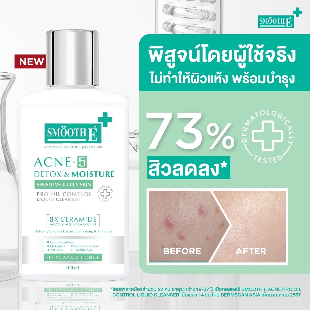 เจลล้างหน้าลดสิว Smooth E Acne-5 Detox Moisture Liquid Cleanser
