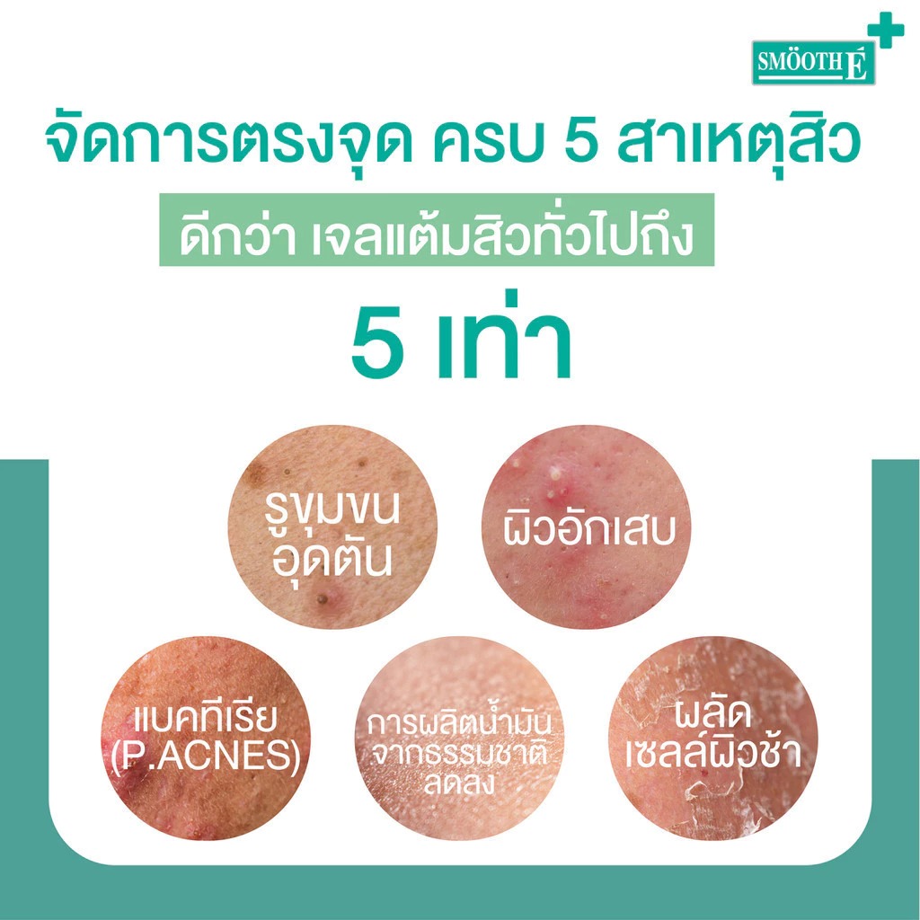 เจลแต้มสิว Smooth E Acne-5 Rapid Action Plus