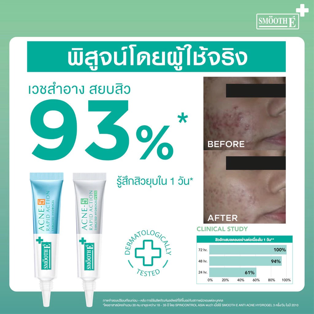 เจลแต้มสิว Smooth E Acne-5 Rapid Action Plus