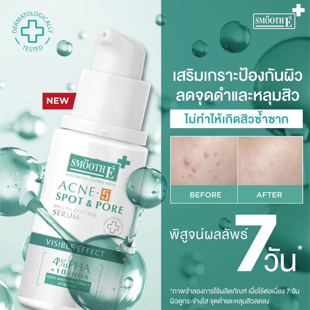 เซรั่มคุมสิว Smooth E Acne-5 Spot Pore Serum