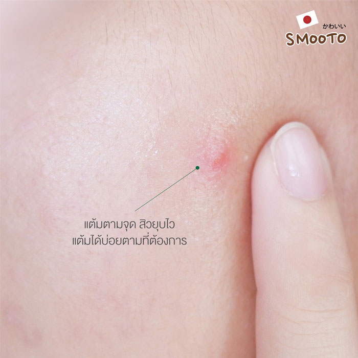 Smooto Anti-Acne Booster Gel เจลแต้มสิว