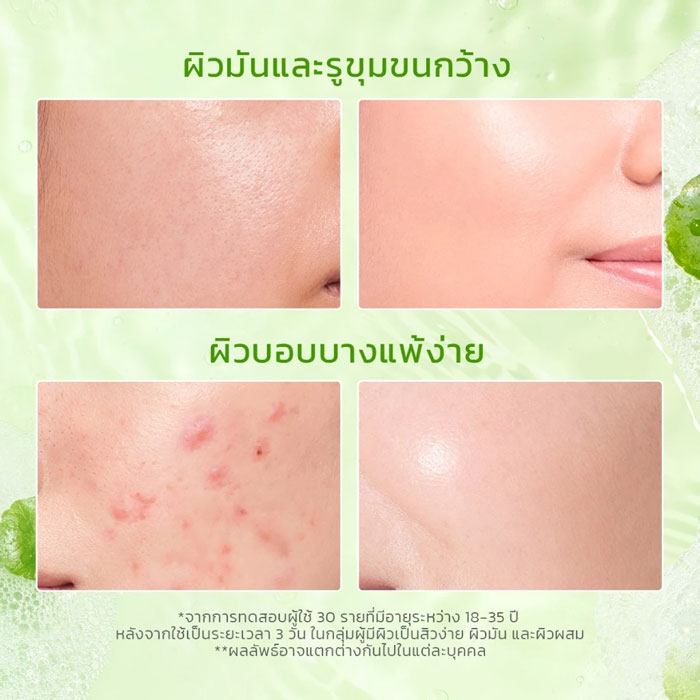 เจลล้างหน้า Glad2Glow Gel Cleanser Centella Salicylic Acid Acne