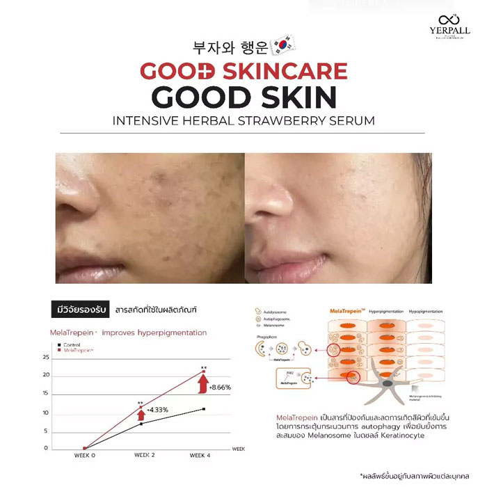 เซรั่ม Yerpall Intensive Herbal Strawberry Serum