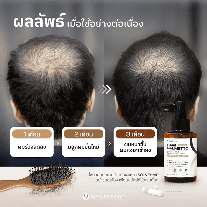 เซรั่มลดผมขาดหลุดร่วง Solve Hair H Regro Saw Palmetto With Caffeine Plus Anti Gray Serum