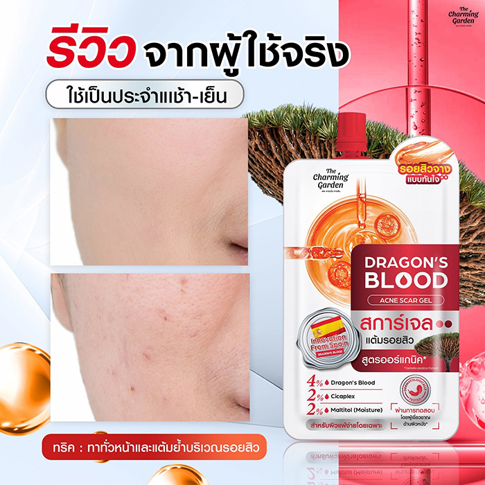 เซรั่ม The Charming Garden Dragon's Blood Acne Scar เซรั่ม The Charming Garden Dragon's Blood Acne Scar