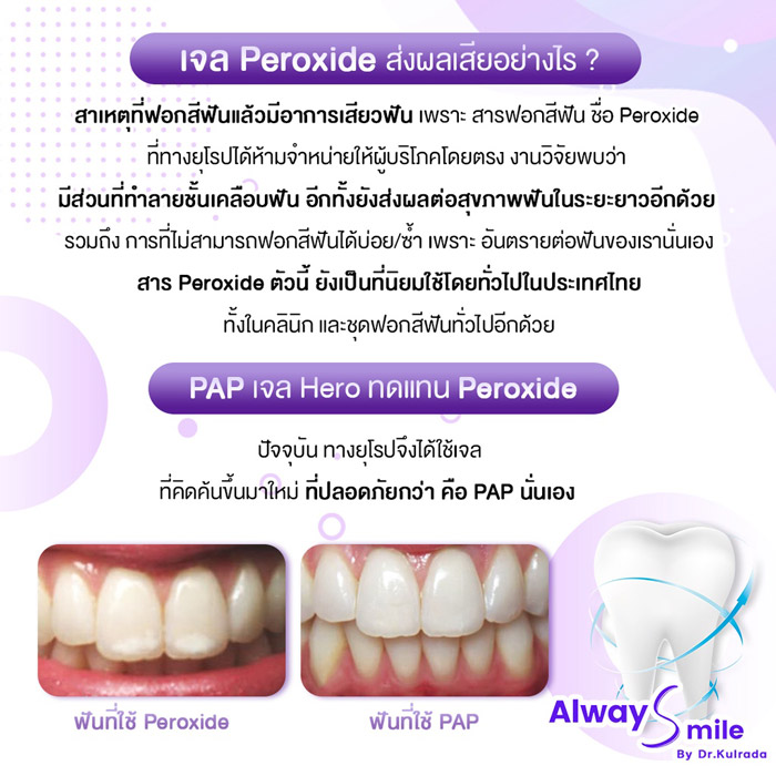 The Na x Dr.Kulrada Alway Smile เชตฟอกสีฟันขาว