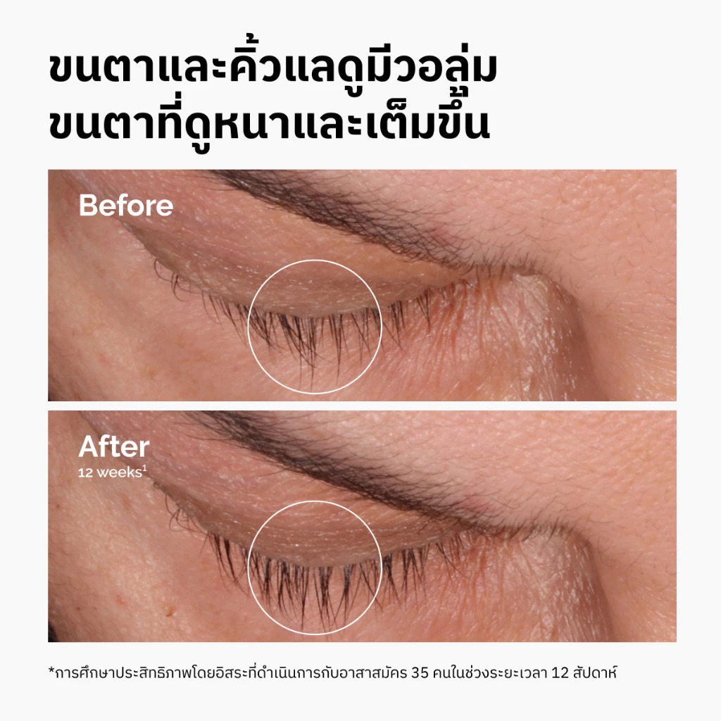เซรั่มบำรุงขนตาและคิ้ว The Ordinary Multi-Peptide Lash & Brow Serum