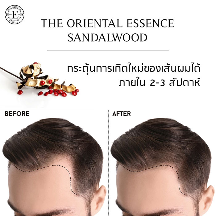 สเปรย์บำรุงผม The Oriental Essence Sandalwood Root Hair Growth Boost Serum