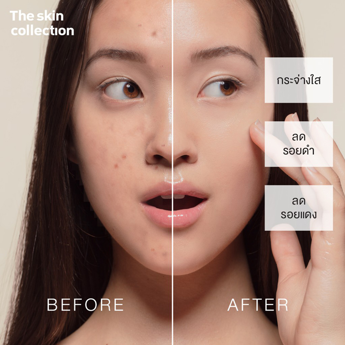 เซรั่ม The skin Collection Serum Niacinamide10% + NAG8%