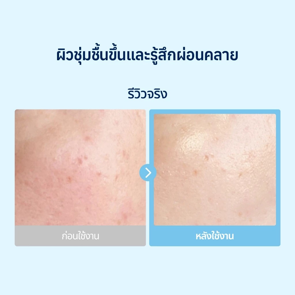 โทนเนอร์แพด Torriden Dive In Low Molecular Hyaluronic Acid Multi Pad