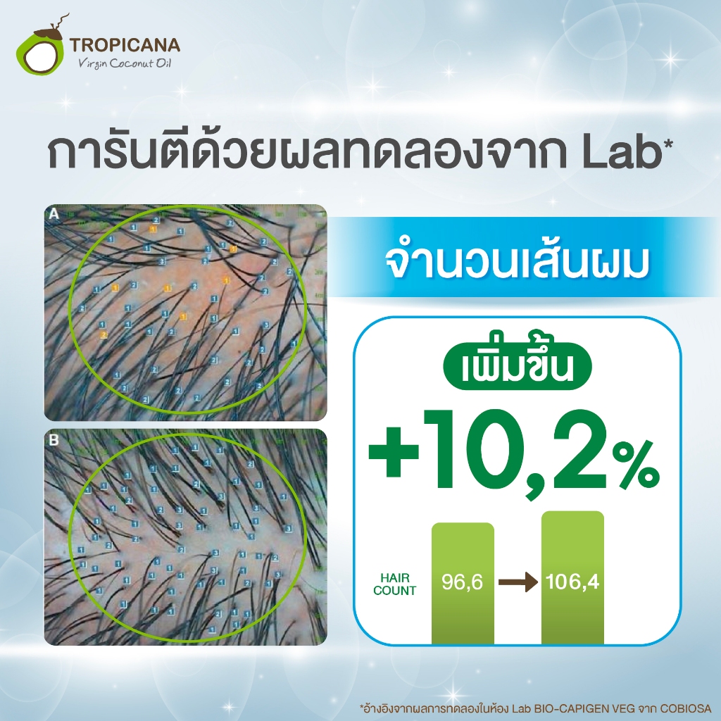 แชมพูลดผมขาดหลุดร่วง Tropicana Coconut Anti-hair loss Shampoo