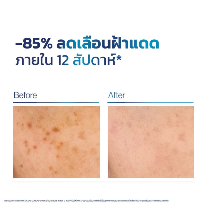 เซรั่มปลุกผิวใส Vaseline Pro Derma Melasma Repair SPF50+ PA++++ เซรั่มปลุกผิวใส Vaseline Pro Derma Melasma Repair SPF50+ PA++++