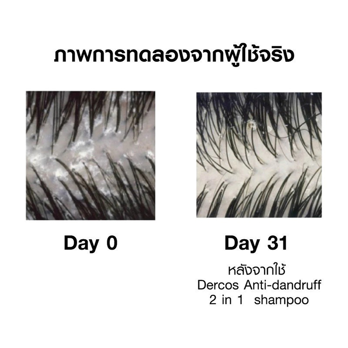 แชมพูผสมครีมนวด VICHY Dercos Anti Dandruff DS 2 in 1 Conditioning Shampoo