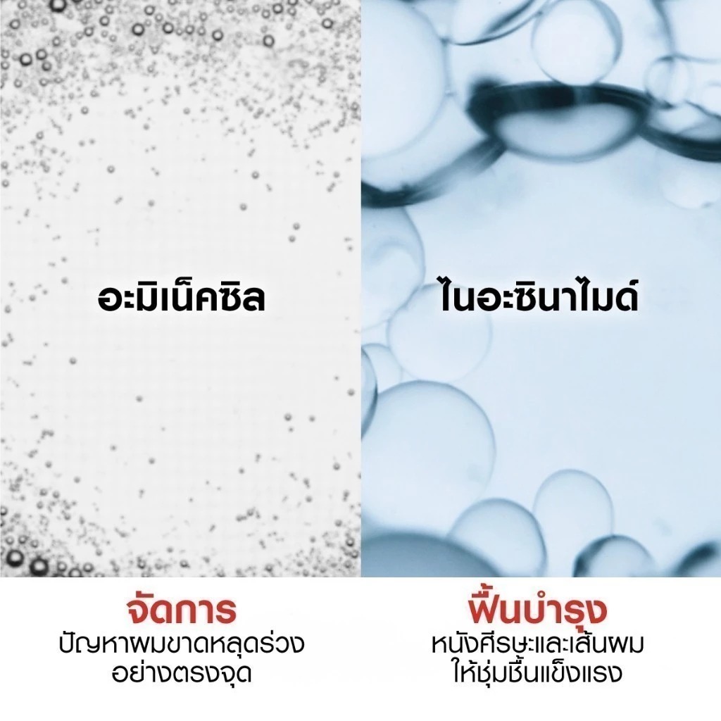 แชมพูลดผมขาดร่วง Vichy Dercos Aminexil Anti-hair loss shampoo