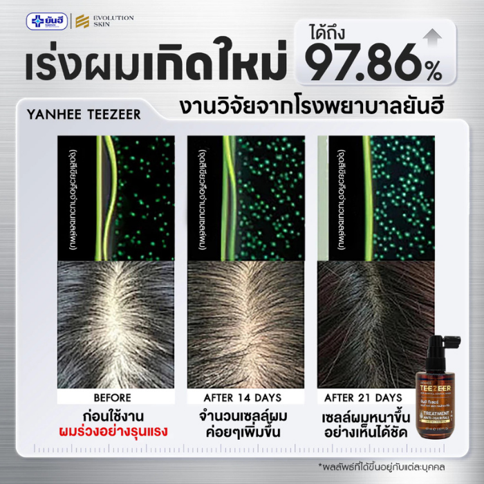 เซรั่มปลูกผม Yanhee Teezeer Anti Hair Fall Control Serum เซรั่มปลูกผม Yanhee Teezeer Anti Hair Fall Control Serum