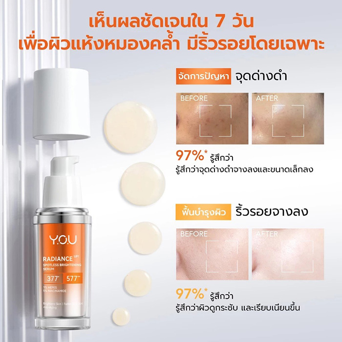เซรั่ม Y.O.U Radiance Up! Spotless Brightening Serum