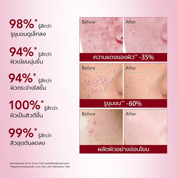 เซรั่ม Y.O.U Reeffect Boost 6% Acid Renewal Peeling Serum