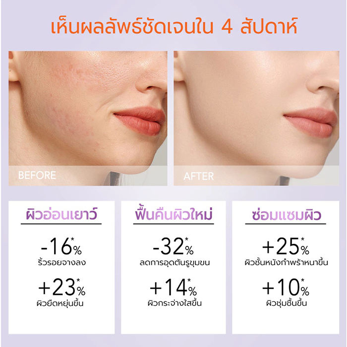 มอยซ์เจอร์ไรเซอร์ Y.O.U Renewal Retinol Moisturizer