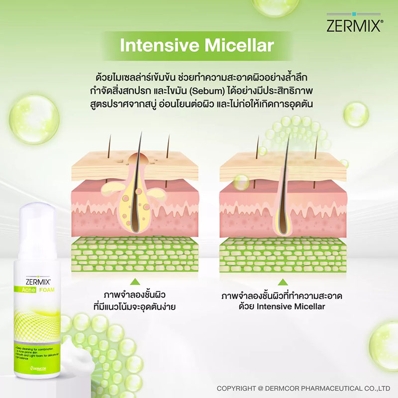 วิปโฟมล้างหน้า Zermix Acne Foam